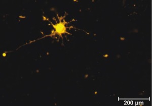 Micrografas de clulas PC12 diferenciadas a clulas neurales creciendo sobre un biomaterial hbrido de fibrona con grafeno, donde se observan las neuritas y conexiones que se establecen entre ellas.