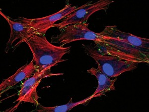 Imagen obtenida mediante microscopa confocal de fibroblastos humanos creciendo en cultivo sobre un film de fibrona de seda. 