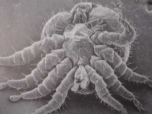 Varroa jacobsoni Oud vista al microscopio electrnico