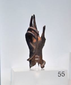 mano sabcea de bronce 
