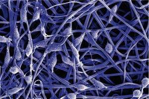 Micrografía de barrido de una malla electrohilada de fibroína de seda con fibroblastos de piel de ratón creciendo sobre la misma. Este material muestra una estructura análoga a la matriz extracelular 